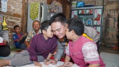 Dua Anak Pengidap Tulang Kaca di Riau Dijenguk Kapolda, Kondisinya Membaik